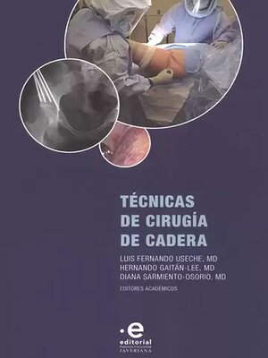 cover image of Técnicas de cirugía de cadera